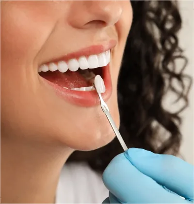 A dentist holds a single shade tab beside a patient's teeth